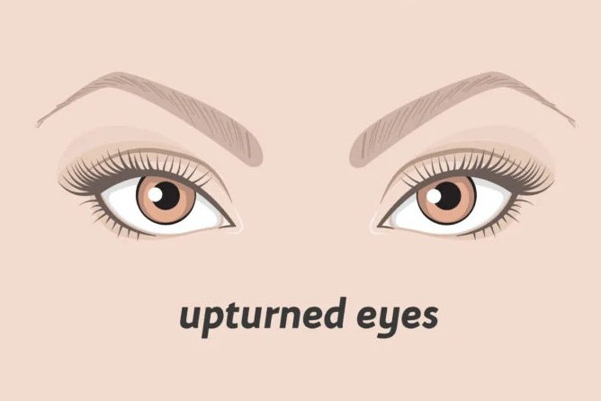 up turned eyes